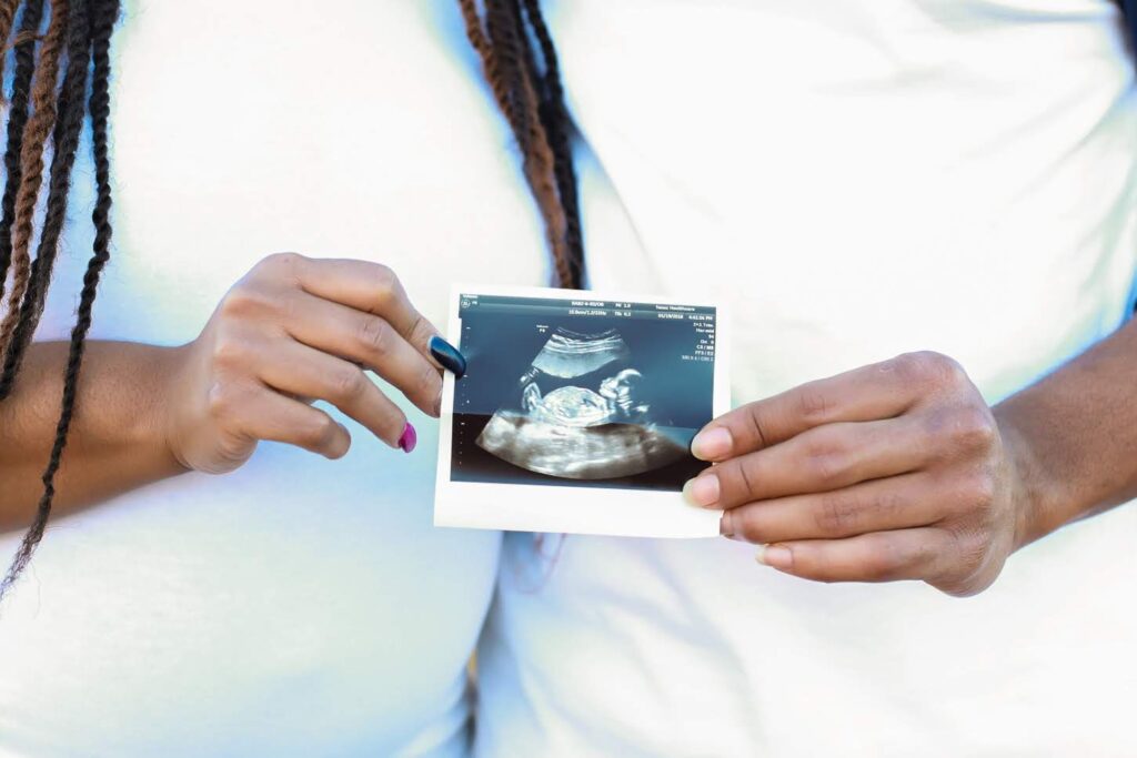 Welcome to Life Without the Baby