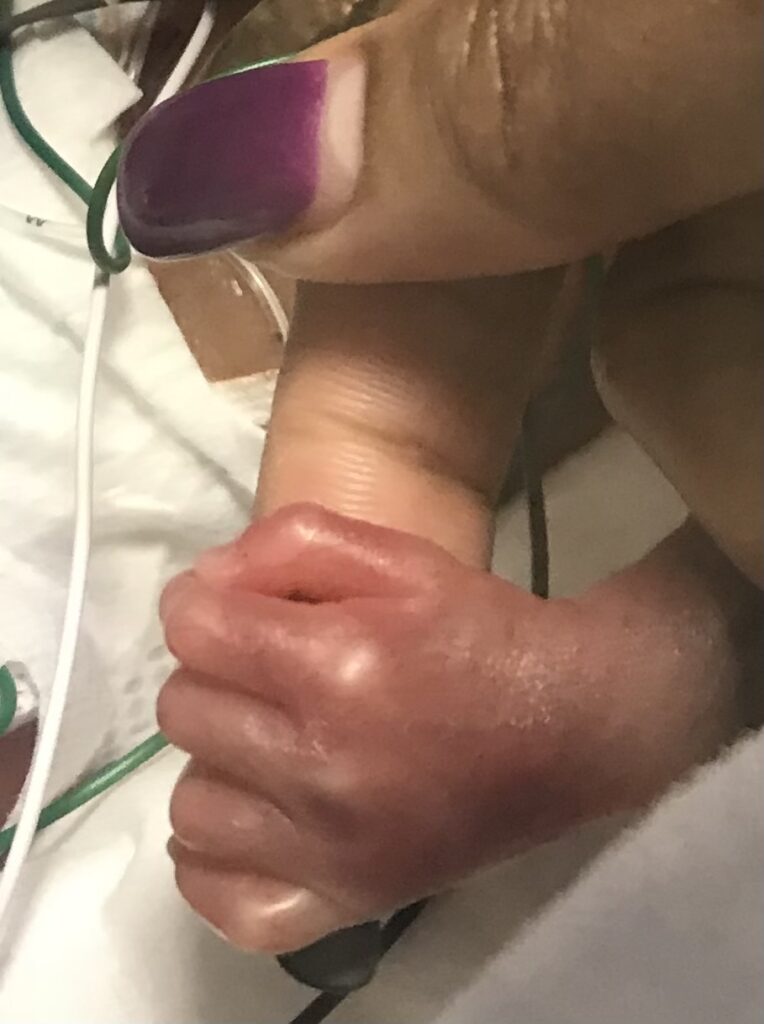 Life Without the Baby: My Heartfelt Reflection